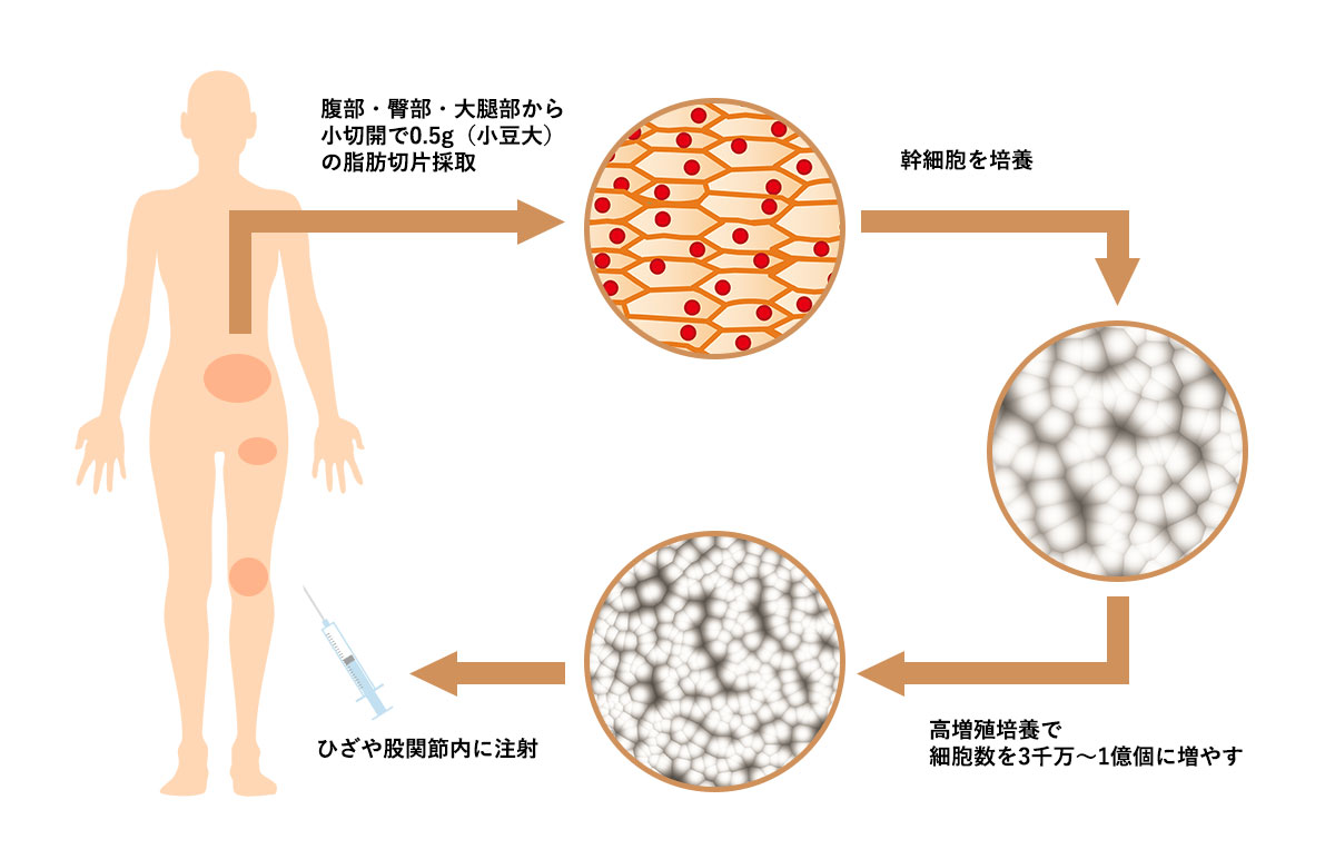 治療の流れ